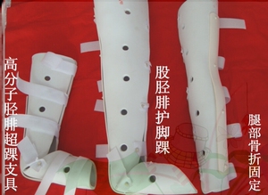 膝关节骨折固定护具髌骨膝盖腿部夹板伸直支撑绑带支具高分子小腿