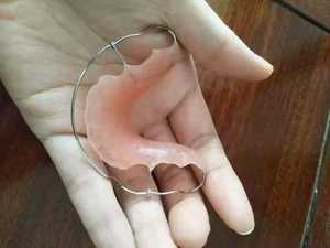 牙齿保持器钢丝