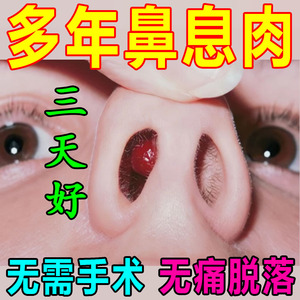 鼻甲肥大鼻塞喷剂