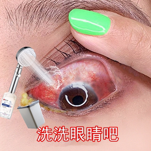 清洁眼睛洗眼液