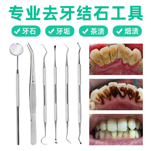 牙结石去除器牙医口腔工具套装材料镜子剔去牙垢牙齿清洁牙科器械