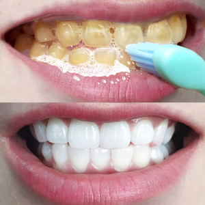 【同仁堂】牙白人更美 牙齿去黄去结石烟渍茶渍牙黄神器男女通用