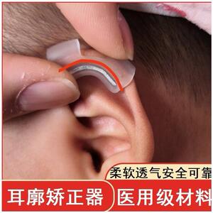 儿童耳朵矫正定型器