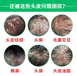 专治毛囊炎药膏
