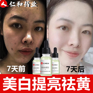 仁和点斑水无痕正品祛斑水去黑斑分解黑色素淡化色素沉着脸部黑印