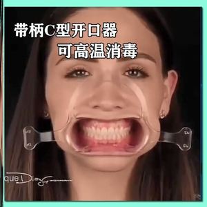扩嘴器口腔张口训练器口腔扩张器钳式口腔不锈钢检查器牙齿撑开器