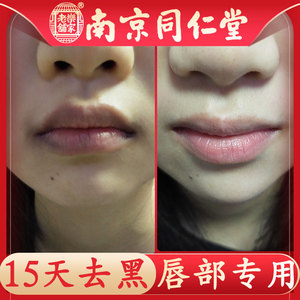 【嘴唇发黑黑色素】嘴唇发黑黑色素品牌,价格 - 阿里巴巴