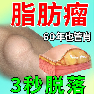 脂肪粒去除神器粉多发性单发大腿胳膊鼓包瘤消除硬块皮腺囊肿膏下