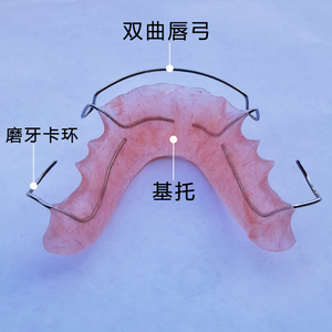 哈雷保持器定做哈利式保持器牙套保持器牙齿保持器定做进口正畸丝