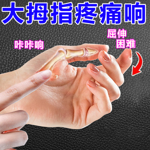 000人付款天猫手腕疼劳损护腕发热药膏大拇指腕管综合症贴腱鞘炎囊肿
