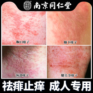 痱子水成人祛痱止痒大人去热痱子水液体爽身粉儿童去痱膏神器喷雾