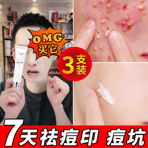 冰溪水杨酸祛痘凝胶祛痘印痘坑修复膏凝胶淡化去痘印痘疤神器芦荟