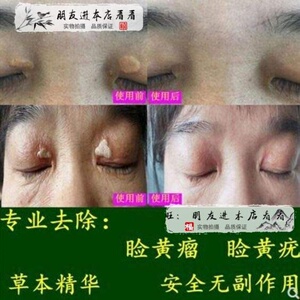黄色橙色睑黄瘤疣去除睑黄疣睑黄瘤斑膏圆眼部黄睑疣康膏眼鉴