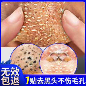 去黑头鼻贴收缩毛孔粉刺深层清洁鼻子祛闭口导出液神器男女士专用