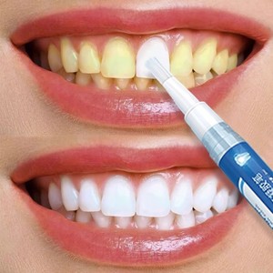 屈臣氐正品牙齿淡白笔涂抹式牙贴美牙神器去黄洗牙变洁白凝胶