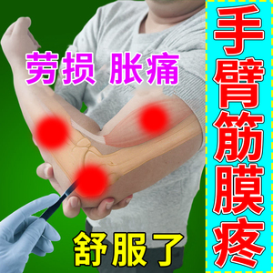 手臂筋膜炎胳膊疼痛肘部外侧肿胀关节僵硬劳损非专用药贴膏yy