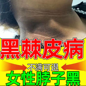 黑棘皮病药膏脖子黑黑的去黑色素沉淀症去除洗不干净后颈治疗zd