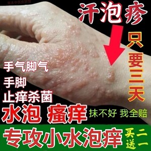 手上起小水泡手痒脚气手气长水泡痒脱皮止痒杀菌干裂汗孢疹癣膏药