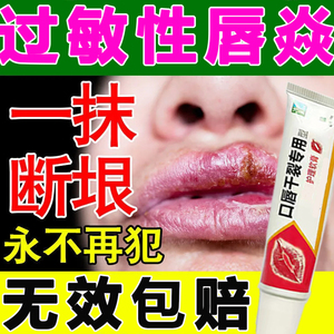 唇炎软膏