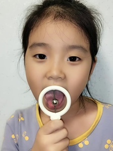 儿童康复训练器材