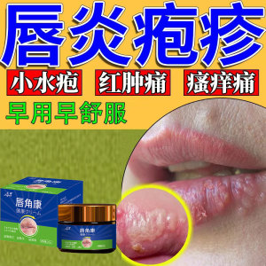 唇炎疱疹嘴巴嘴唇口嘴角炎膏上火脱皮起水泡红肿痒羊胡子疮药专用