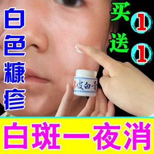 【买一送一】儿童成人白色糠疹药膏脸上白斑长癣鳞屑单纯糠疹虫斑