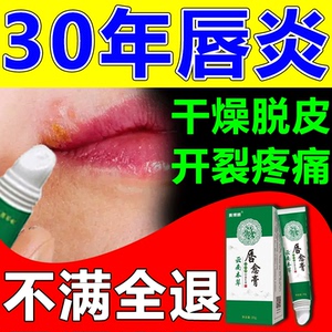 口角炎药膏烂嘴角唇炎成人儿童嘴角起泡干裂疼痛口周皮炎润唇日本