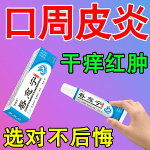 儿童唇炎专用药小孩舔嘴唇口周皮炎嘴唇干皮干裂红肿瘙痒润唇膏