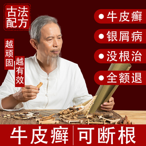 牛皮癣特效药中药去根银屑病专用外用药水复方黄柏祛癣搽剂老偏方