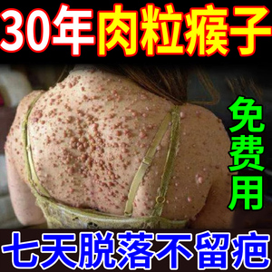 脖子上长小肉粒丝状疣去除猴子皮肤疣瘊子腋下皮赘肉痣正品疣瘊净