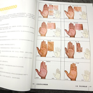 王晨霞掌纹图典 正版诊病治病手诊书教程书籍看手相中医养生保健