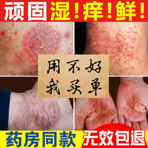 百草止痒膏根肛周湿疹去阴囊抑菌去男女外阴私处大腿内侧皮肤瘙痒