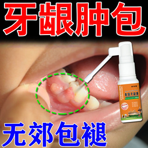 牙龈馕肿牙龈肿包鼓包牙根有脓块红疼痛抑菌喷剂牙周炎牙龈萎缩药