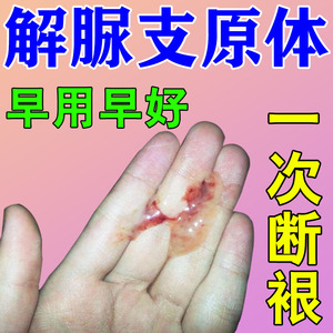 解脲支原体衣原体感染药阳性凝胶女尿路感染尿道炎专用妇科炎症用