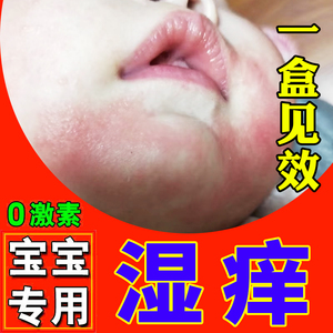 宝宝湿疹霜专用儿童湿止痒疹无激素脸上婴幼儿干性身体乳去根