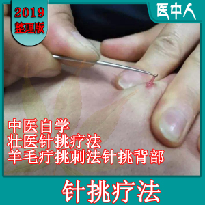 自学课:中医自学壮医针挑疗法羊毛疔挑刺法针挑背部高清视