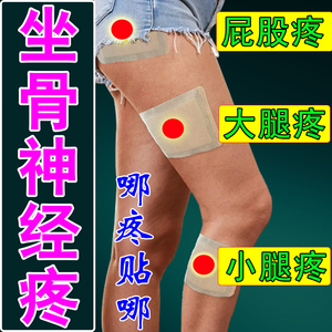 坐骨神经疼【专用药】贴膏腰椎突出压迫屁股疼腿疼腰疼止痛神器