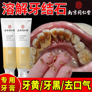 牙膏牙龈出血美白去黄去口臭抗敏正品牙结石专溶解牙石去除器