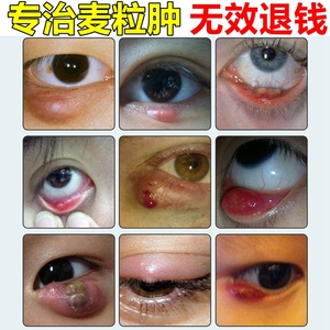 儿童恒温蒸汽热敷眼罩缓视疲劳干眼症睑板腺堵塞霰麦粒肿疏通近视