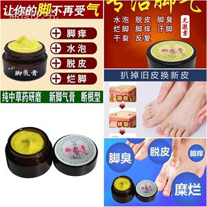 抑脱脚皮烂脚气去根神器气药脚治脱根皮止痒杀脚气菌偏方 菌乳膏1
