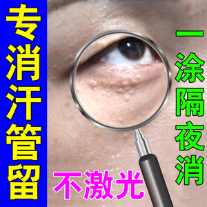 祛除汗管瘤眼部去除神器脂肪粒专用药无痛无痕油脂粒日本正品眼霜