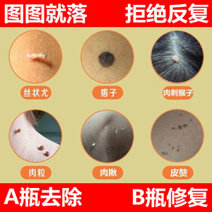 000人付款淘宝脖子上长的小肉粒疙瘩去除膏身上腋下皮赘去瘊疣猴子药