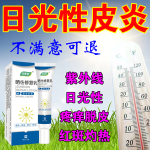 日光性皮炎皮肤晒伤修复膏男士儿童紫外线过敏面部脖子痛蜕皮止痒