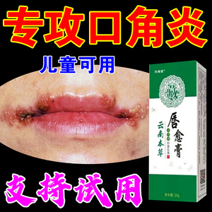 口角炎日本口周皮炎药膏唇炎润唇膏儿童口唇炎烂专用药膏嘴角干裂