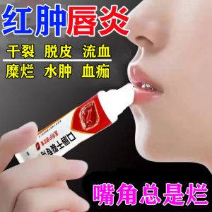 唇炎专用口周皮炎药膏成人儿童烂嘴角唇周干裂起泡脱皮专用软膏药