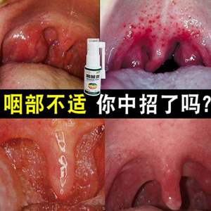 治疗咽喉炎慢性咽炎滤泡增生淋巴异物感咳嗽止咳化痰花茶嗓子偏方