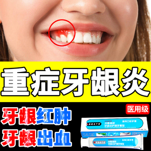 牙龈炎专用牙膏牙龈萎缩修复出血肿痛红肿非药牙周炎敏感治疗消炎