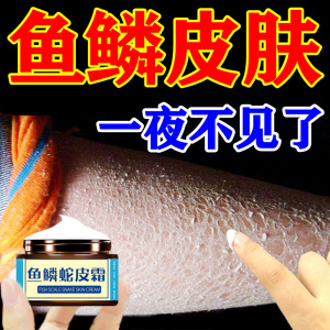 鱼鳞皮肤霜去除鱼鳞症克星药膏治蛇皮腿部护肤乾燥脱皮身体乳