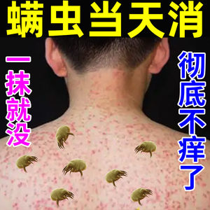 除螨虫药膏紫草药膏毛囊炎药膏烧伤药膏真菌药膏抑菌鸡皮肤药膏祛疤