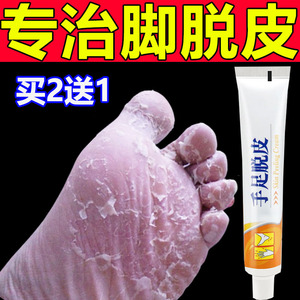 手上起皮干燥脱皮药膏手足粗糙掉皮专用真菌感染手脚干裂蜕皮干燥